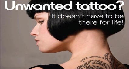 Tattoos removal serices in delhi/ncr